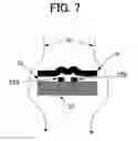 Fig. 05 - SQUID magnetic sensor