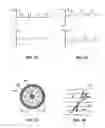 Fig. 04 - SYNAPTIC VESICLE CYCLING ASSAYS AND SYSTEMS