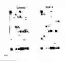 Fig. 09 - THERAPEUTIC METHOD FOR INCREASING PANCREATIC BETA CELL MASS