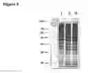 Fig. 03 - Protein extraction methods