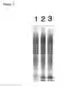 Fig. 04 - Protein extraction methods