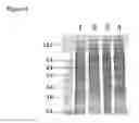 Fig. 05 - Protein extraction methods
