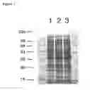 Fig. 06 - Protein extraction methods