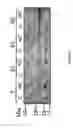 Fig. 04 - Reengineering mRNA primary structure for enhanced protein production