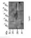 Fig. 06 - Reengineering mRNA primary structure for enhanced protein production