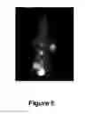 Fig. 06 - Synthesis of 2′-deoxy-2′-[F]fluoro-5-methyl-1-B-D-arabinofuranosyluracil (F-FMAU)
