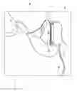 Fig. 12 - Sound transducer for insertion in an ear
