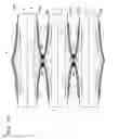 Fig. 13 - Sound transducer for insertion in an ear