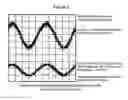 Fig. 04 - Apparatus and methods to improve sleep, reduce pain and promote natural healing