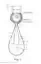 Fig. 04 - Method of treating urinary incontinence
