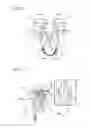 Fig. 03 - Centering aid for implantable sling