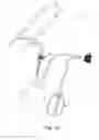 Fig. 16 - Inflatable penile implant
