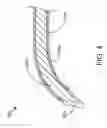 Fig. 05 - Devices and methods for inserting a sinus dilator