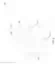 Fig. 05 - Highly Articulable Catheter