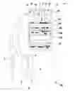 Fig. 01 - Process and a device for determining conditions of hypovolemia