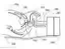 Fig. 01 - Trans-perineal prostate MR elastography