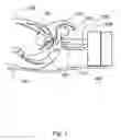 Fig. 02 - Trans-perineal prostate MR elastography