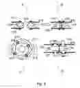 Fig. 10 - Trans-perineal prostate MR elastography