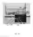 Fig. 11 - Trans-perineal prostate MR elastography