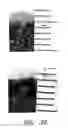 Fig. 45 - Methods For Non-Invasive Lifting And Tightening Of The Lower Face And Neck