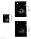 Fig. 10 - Ultrasonic image processing with directional interpolation in order to increase the resolution of an image