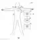 Fig. 02 - Wireless ECG in implantable devices
