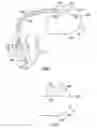 Fig. 06 - Wireless ECG in implantable devices
