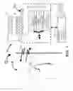 Fig. 02 - Ischemia detection based on combination of parameters associated with different sensors