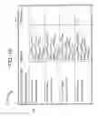 Fig. 19 - Ischemia detection based on combination of parameters associated with different sensors