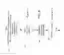 Fig. 11 - Acute ischemia detection based on parameter value range analysis