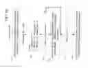 Fig. 13 - Acute ischemia detection based on parameter value range analysis