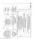 Fig. 14 - Acute ischemia detection based on parameter value range analysis
