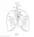Fig. 07 - Catheter Having Needle And Expandable Support Member And Methods Of Use
