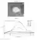 Fig. 11 - All electric piezoelectric finger sensor (PEFS) for soft material stiffness measurement