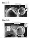 Fig. 16 - Bladder driven linear cylinder and associated devices driven thereby
