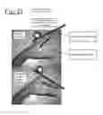 Fig. 22 - Bladder driven linear cylinder and associated devices driven thereby