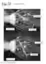 Fig. 26 - Bladder driven linear cylinder and associated devices driven thereby
