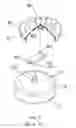 Fig. 03 - MANUAL AND CYCLONIC MASSAGE DEVICE