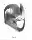 Fig. 04 - Adjustable cervical collar