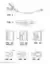 Fig. 02 - Loop-tip catheter
