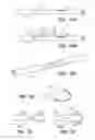 Fig. 08 - Loop-tip catheter