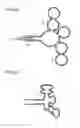 Fig. 12 - Method for treatment of emphysema