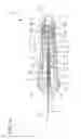 Fig. 03 - Neonatal and pediatric catheter system