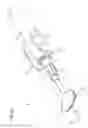 Fig. 07 - Neonatal and pediatric catheter system