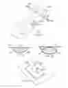 Fig. 03 - Apparatus and method for deploying a surgical preparation