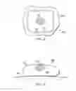 Fig. 06 - Apparatus and method for deploying a surgical preparation