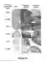 Fig. 03 - Tissue repair with multipotent cells