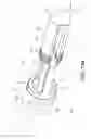 Fig. 28 - Catheter device