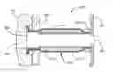Fig. 01 - Devices and methods for dilating a paranasal sinus opening and for treating sinusitis