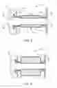Fig. 04 - Devices and methods for dilating a paranasal sinus opening and for treating sinusitis